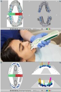 T scan device